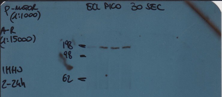 TOR/mTOR [p Ser2448] Antibody - BSA Free NB600-607