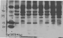IL-1 beta/IL-1F2 Antibody - Azide and BSA Free NB600-633