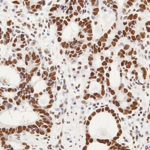 GLI-2 Antibody - BSA Free NB600-874