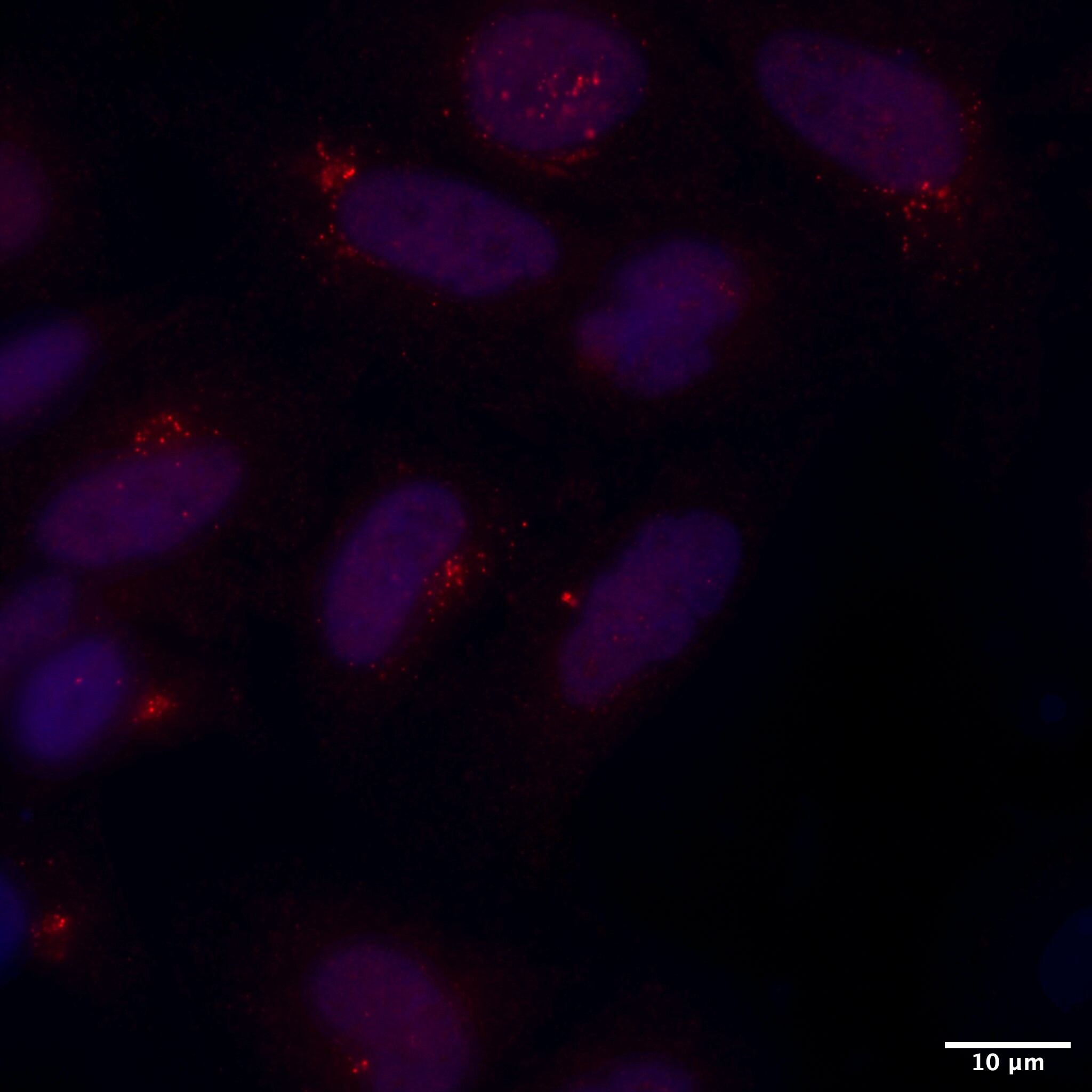 LAMP-1/CD107a Antibody - BSA Free NB600-956