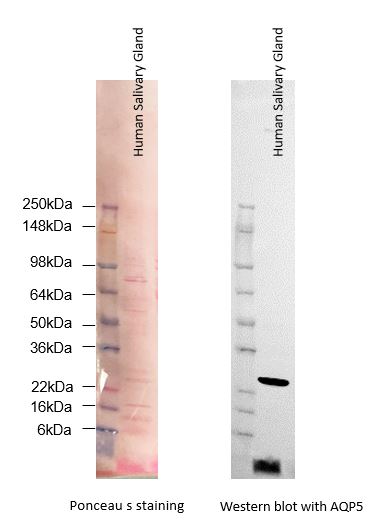 Human Salivary Gland Whole Tissue Lysate (Adult Whole Normal) NB820-59251
