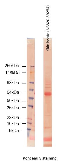 Human Skin Whole Tissue Lysate (Adult Whole Normal) NB820-59254