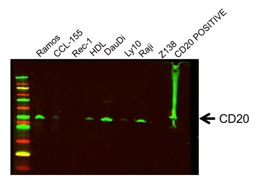 CD20 Overexpression Lysate NBL1-13312