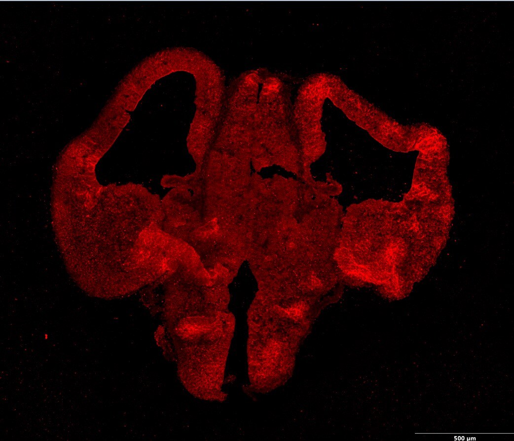 DACH1 Antibody NBP1-00136