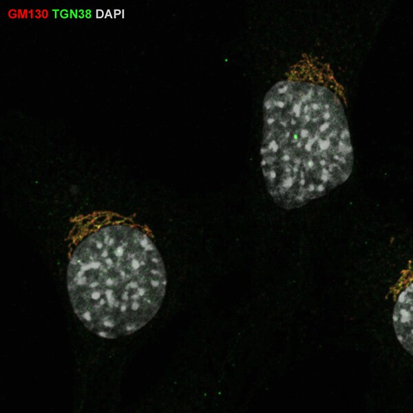 TGN38 Antibody - Azide and BSA Free NBP1-03495