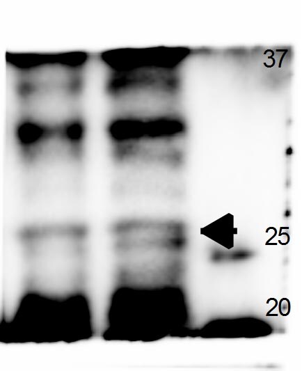 Lipocalin-2/NGAL Antibody (32) - BSA Free NBP1-05182
