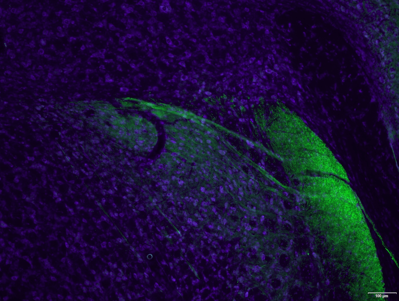 Peripherin Antibody - BSA Free NBP1-05423
