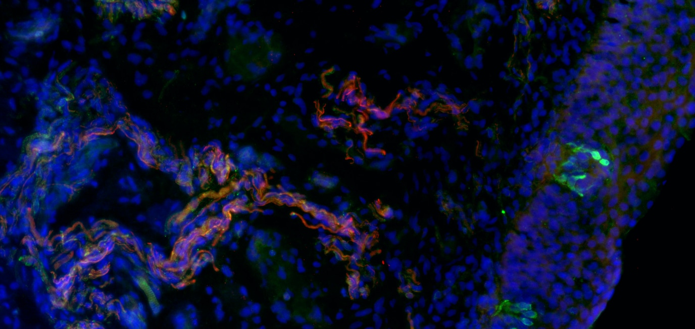 Peripherin Antibody - BSA Free NBP1-05423