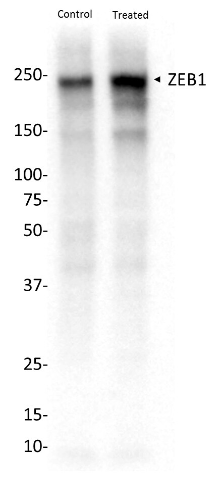 ZEB1 Antibody NBP1-05987