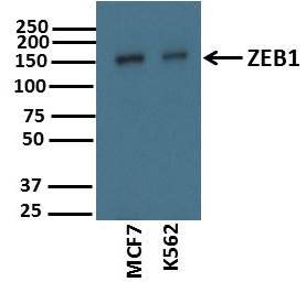 ZEB1 Antibody NBP1-05987