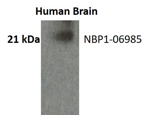 Ferritin Heavy Chain Antibody NBP1-06985