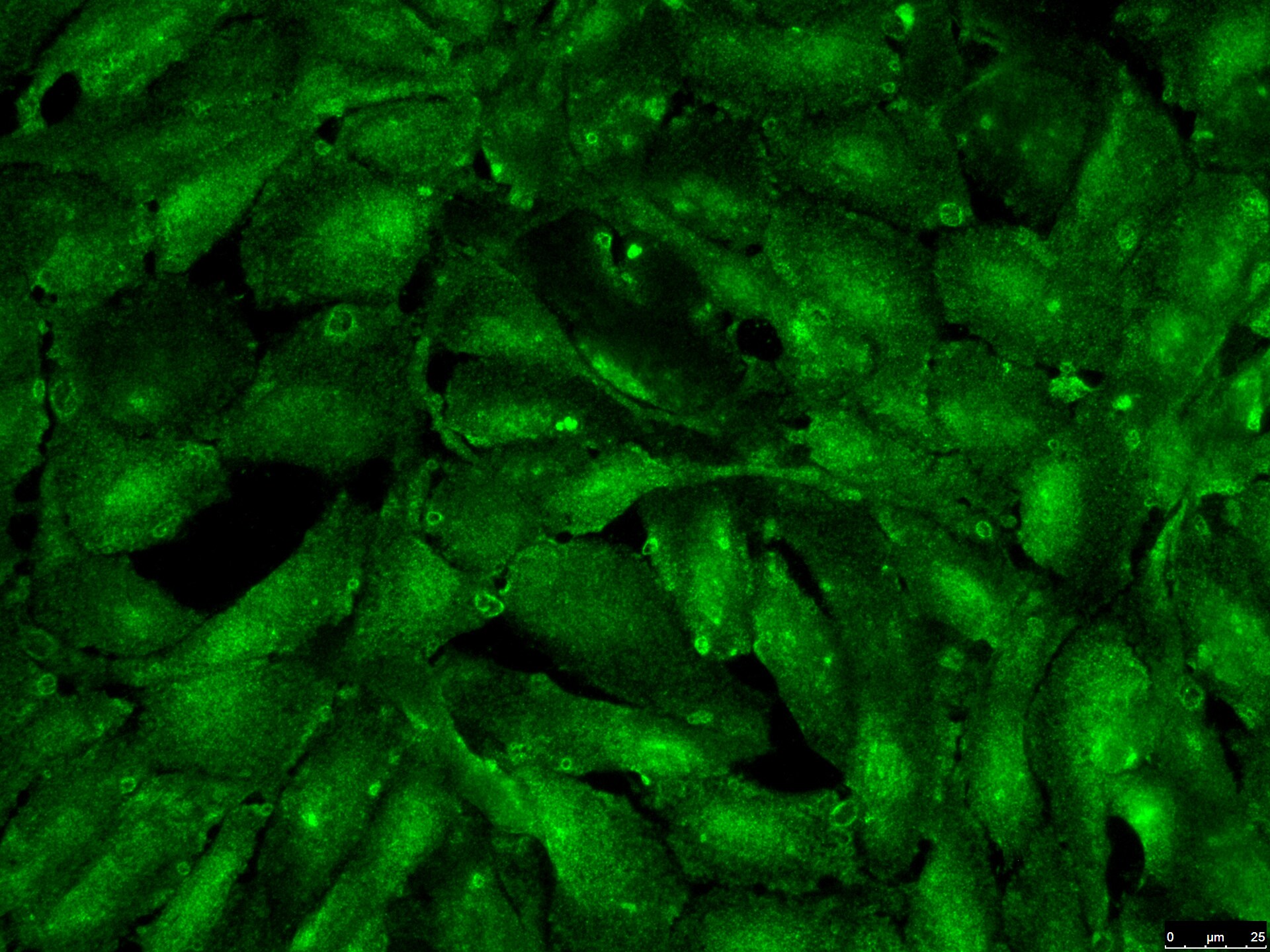 Ferritin Heavy Chain Antibody NBP1-06985