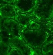 VEGF-C Antibody (107/F10) - Azide and BSA Free NBP1-18626