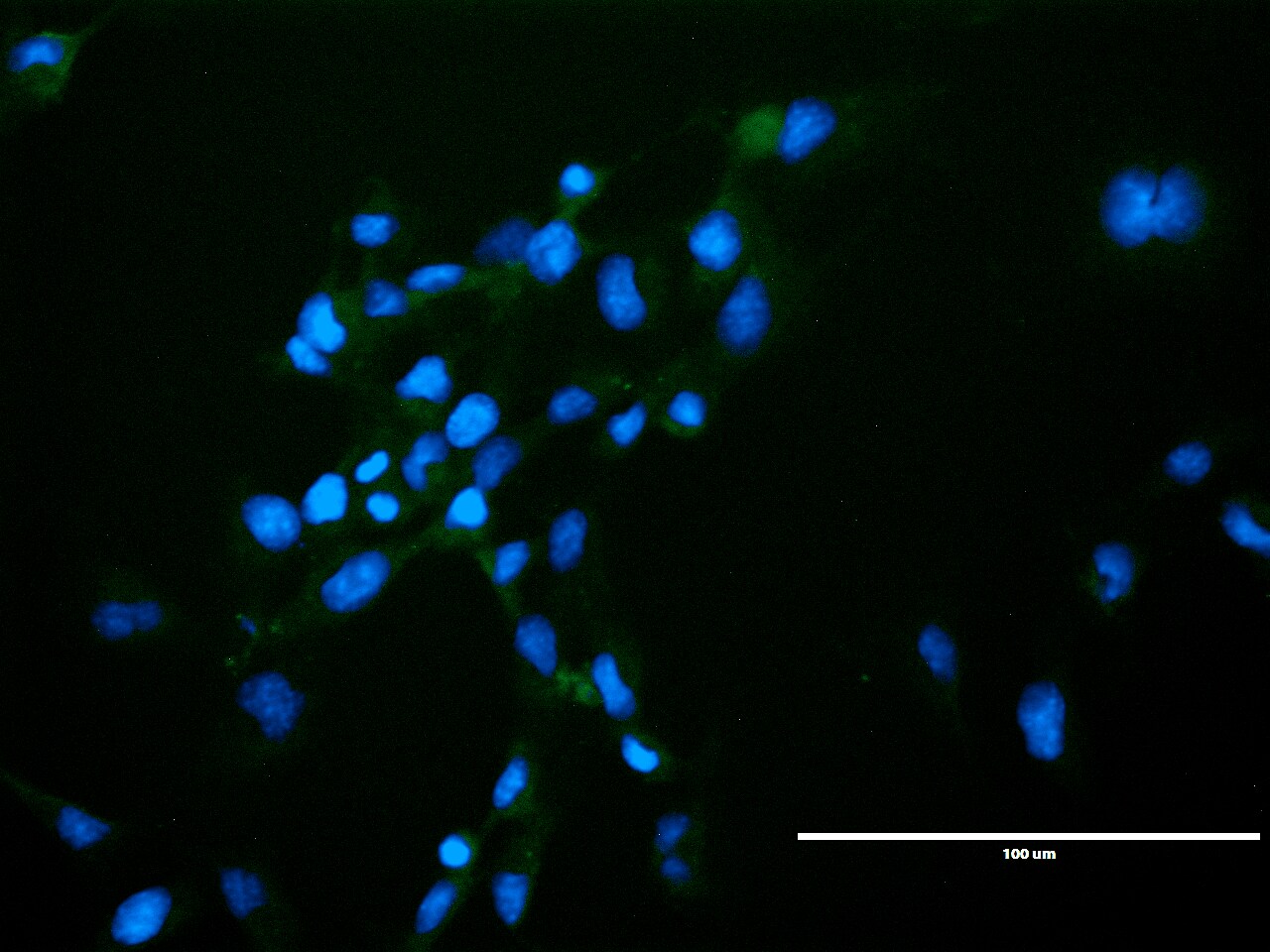 VEGFR2/KDR/Flk-1 Antibody (20I6) [Alexa Fluor® 488] NBP1-18646AF488