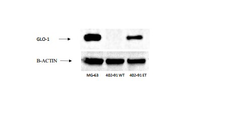 Glyoxalase I Antibody (Glo1a) - BSA Free NBP1-19015