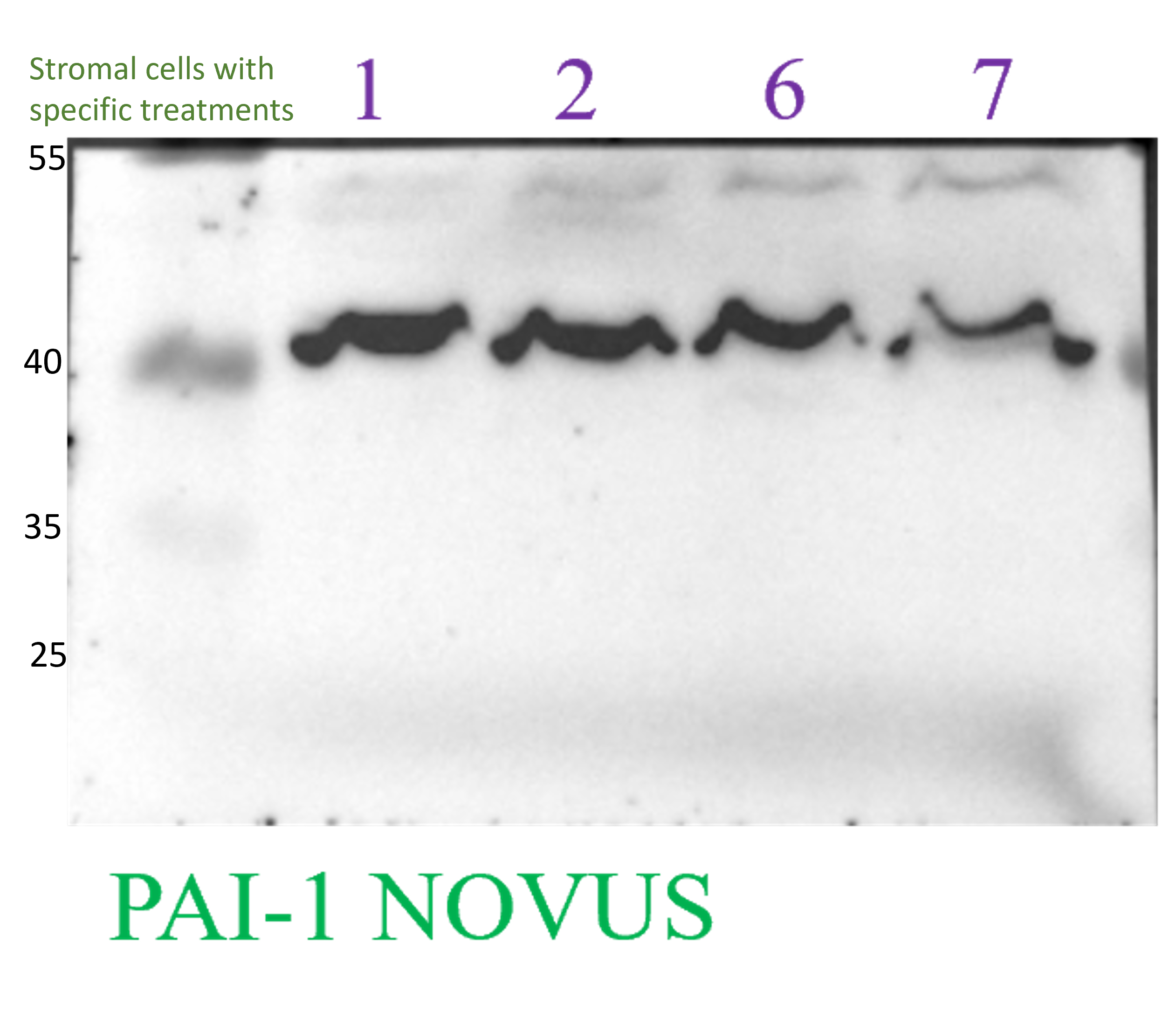 Serpin E1/PAI-1 Antibody - BSA Free NBP1-19773
