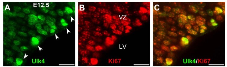 ULK4 Antibody NBP1-20229