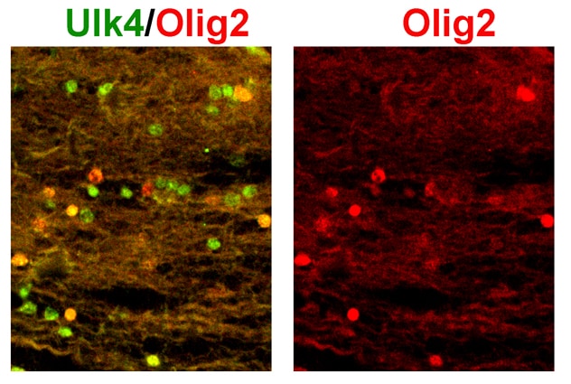 ULK4 Antibody NBP1-20229