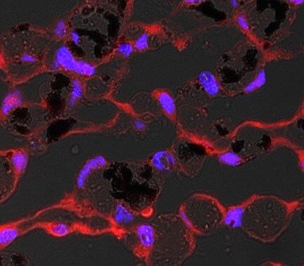 Ferroportin/SLC40A1 Antibody - BSA Free NBP1-21502