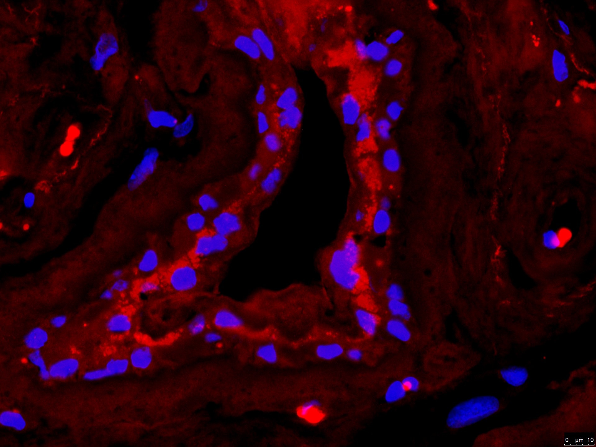 Ferroportin/SLC40A1 Antibody - BSA Free NBP1-21502