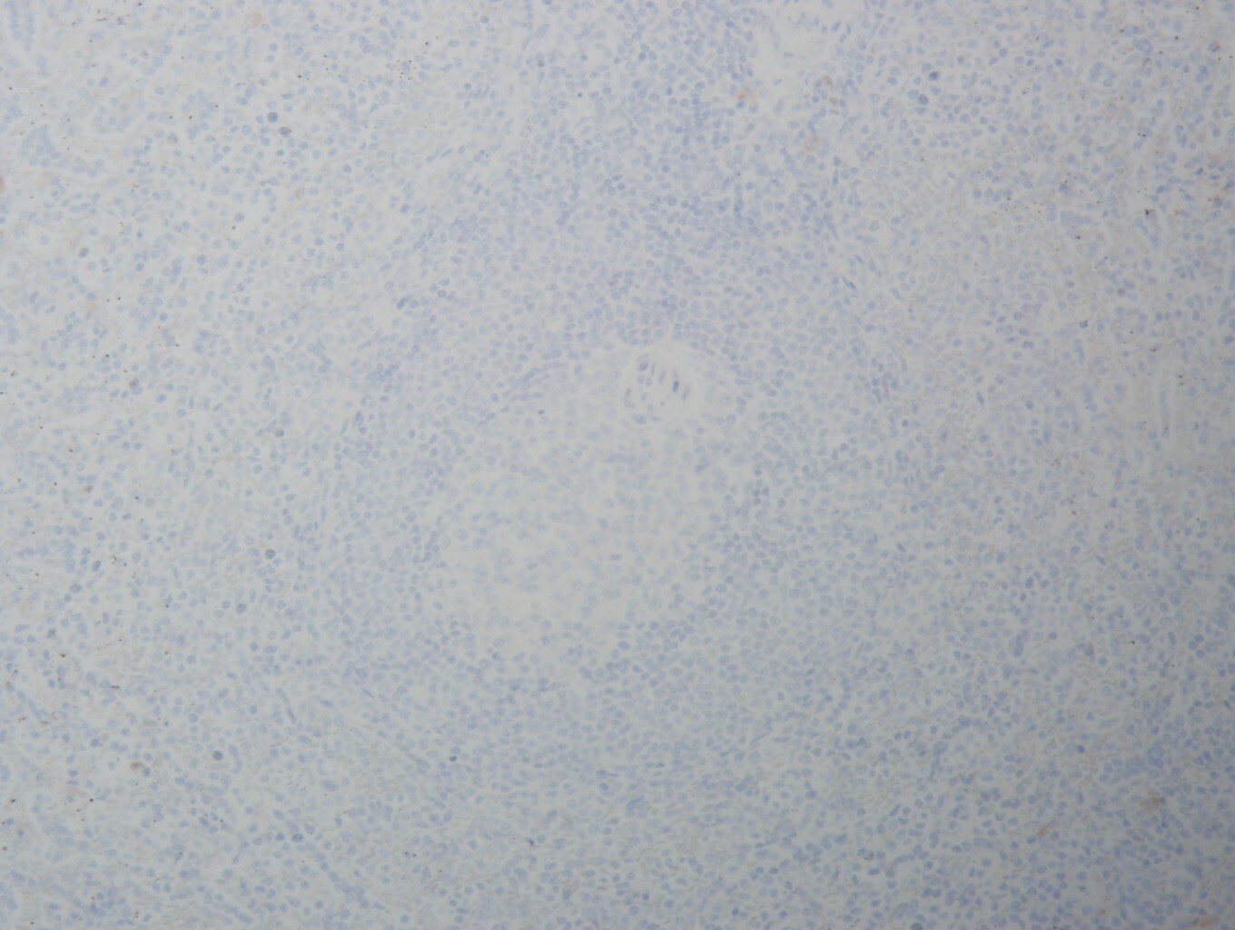 CD21 Antibody (1F8) NBP1-22527