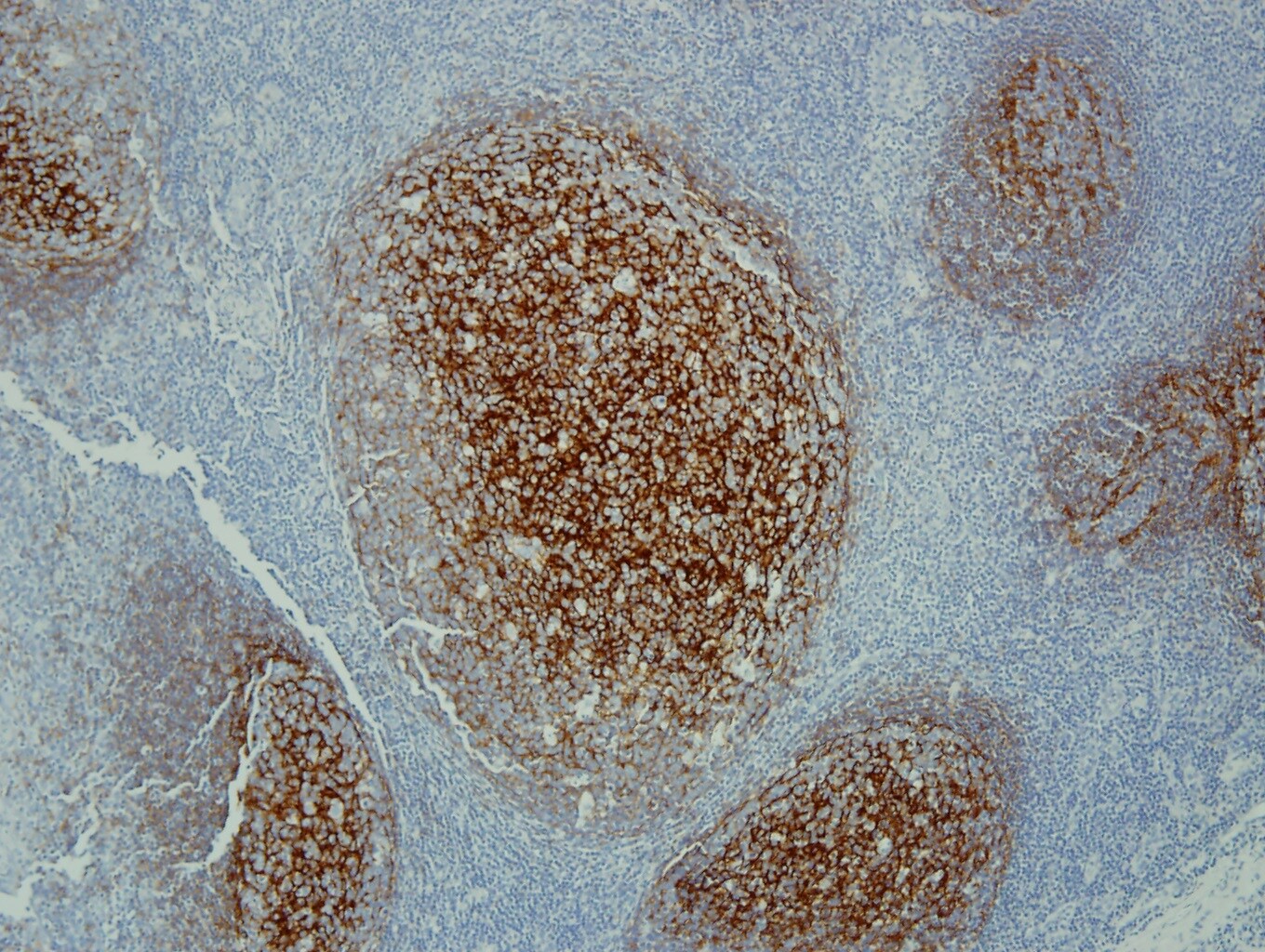 CD21 Antibody (1F8) NBP1-22527