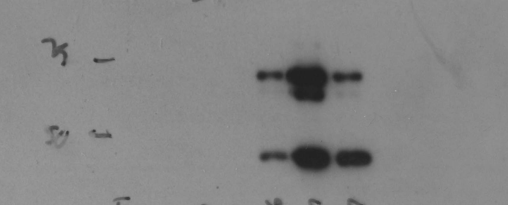 Cytomegalovirus Antibody (DDG9 and CCH2) NBP1-22532