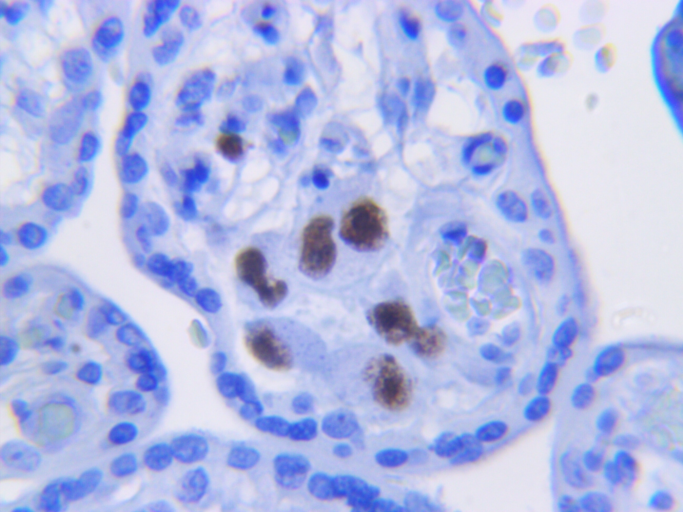 Cytomegalovirus Antibody (DDG9 and CCH2) NBP1-22532