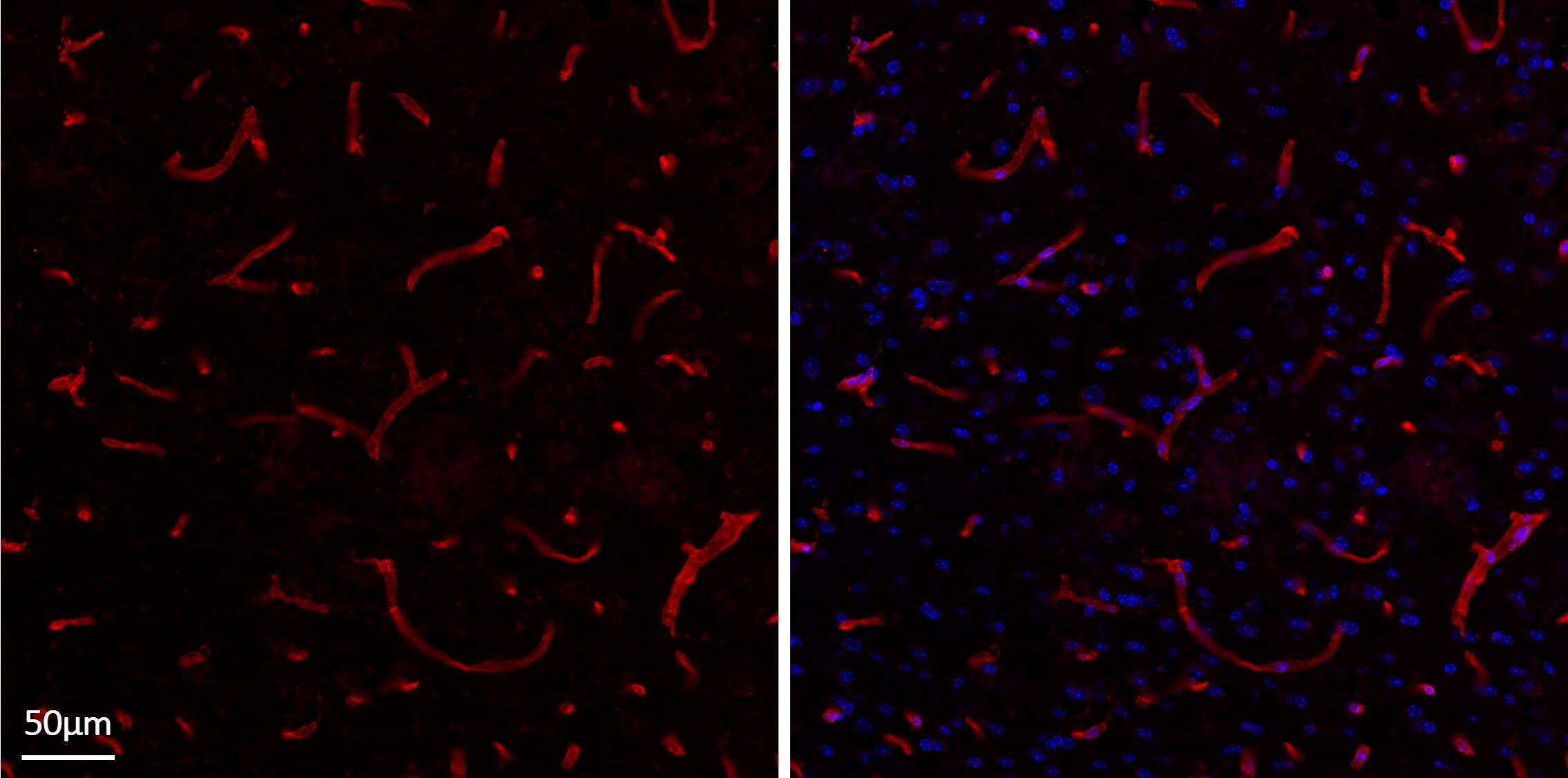 Collagen IV Antibody - Azide and BSA Free NBP1-26549