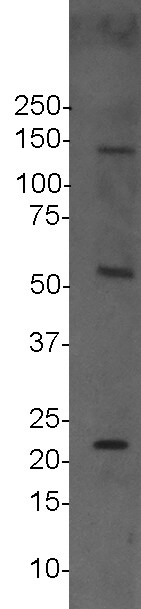 DHX30 Antibody NBP1-26603