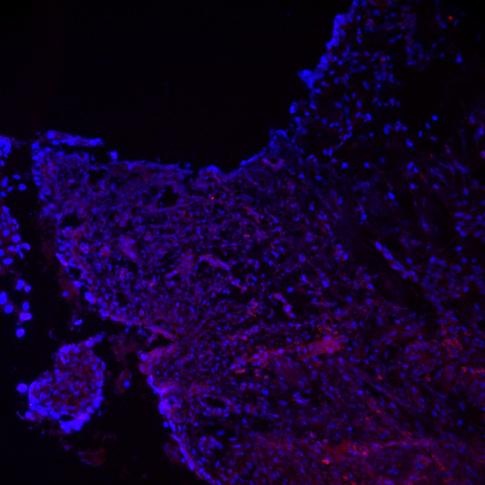 CD19 Antibody (SJ25-C1) - Azide and BSA Free NBP1-28375