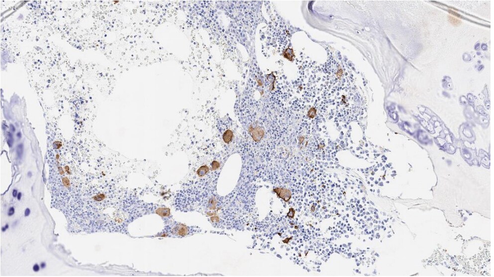 CD42b/GPIb alpha Antibody (MM2/174) - Azide and BSA Free NBP1-28457