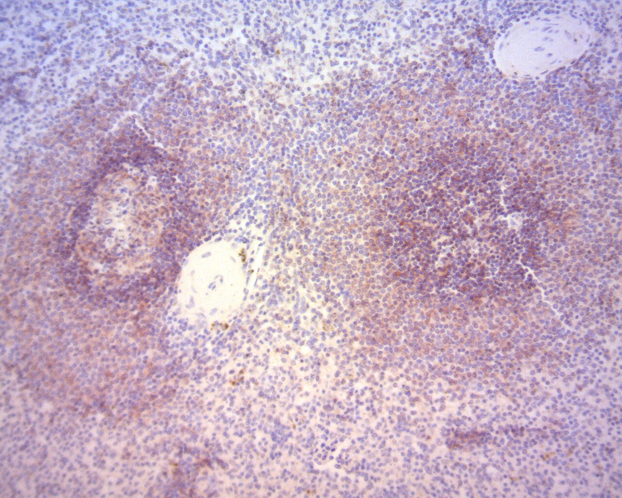 CD37 Antibody (2B8) NBP1-28869