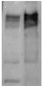 Lipocalin-2/NGAL Antibody (04) - BSA Free NBP1-30000