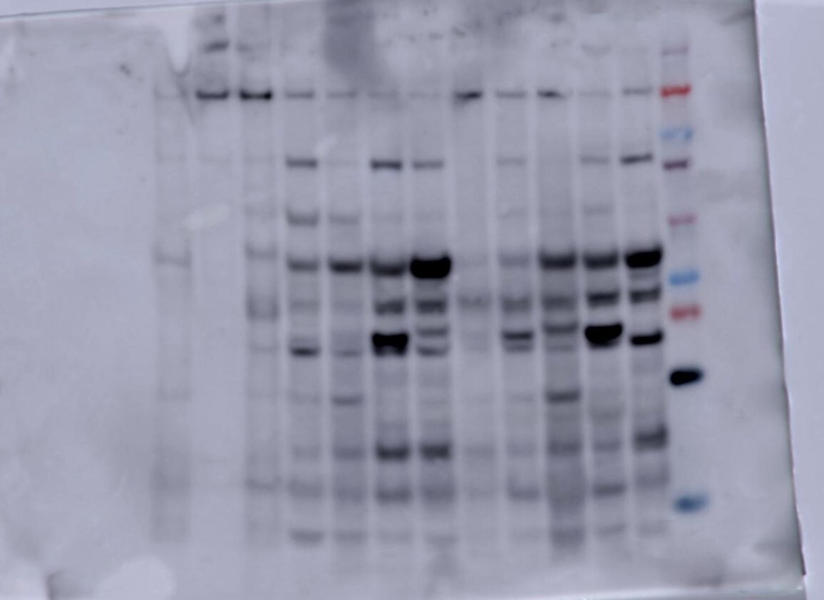 Collagen I alpha 1 Antibody - Azide and BSA Free NBP1-30054