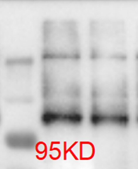 BRD2 Antibody NBP1-30475