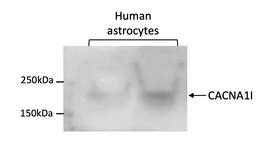 CACNA1I Antibody - Azide and BSA Free NBP1-30674