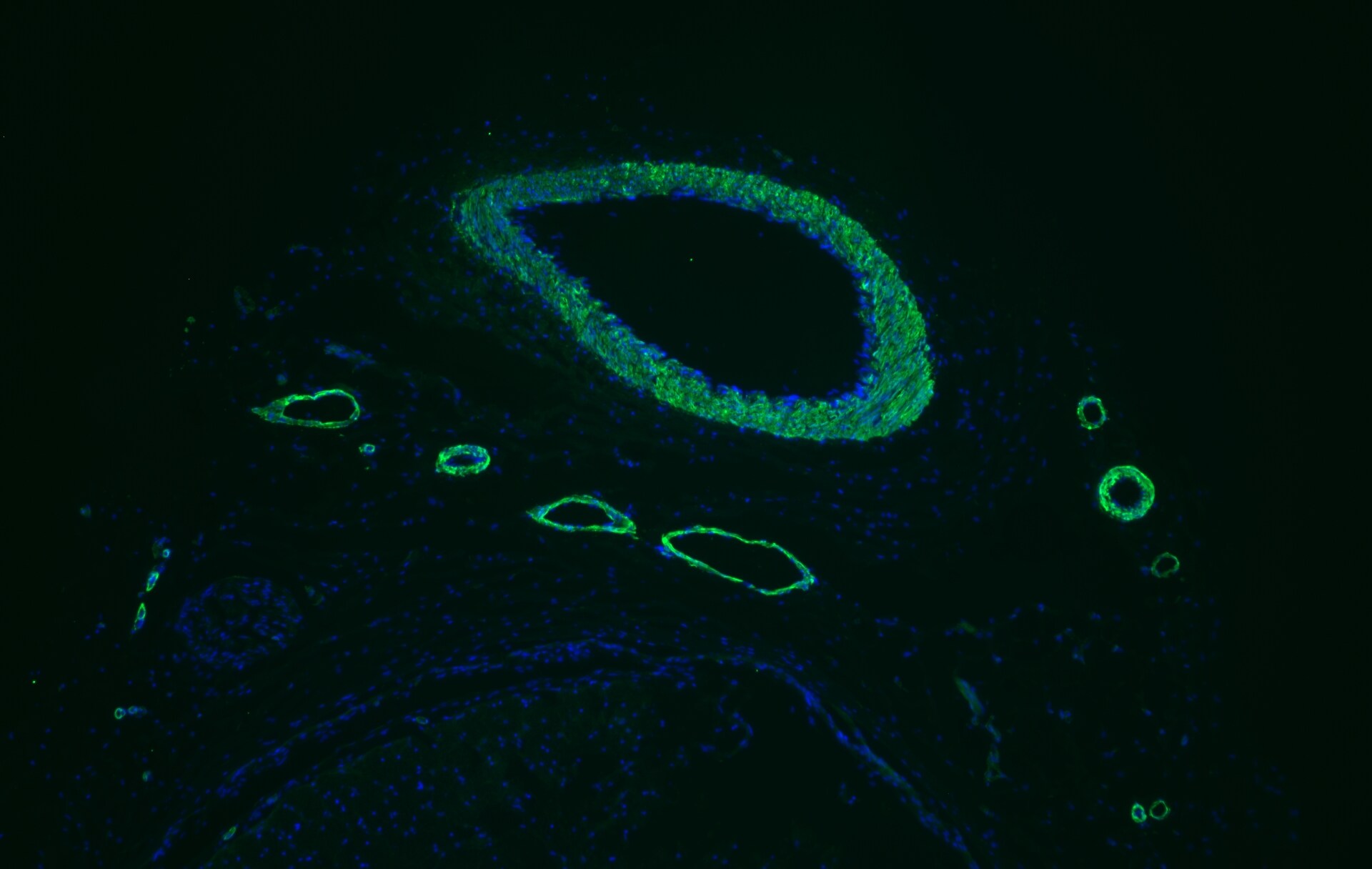 alpha-Smooth Muscle Actin Antibody - BSA Free NBP1-30894