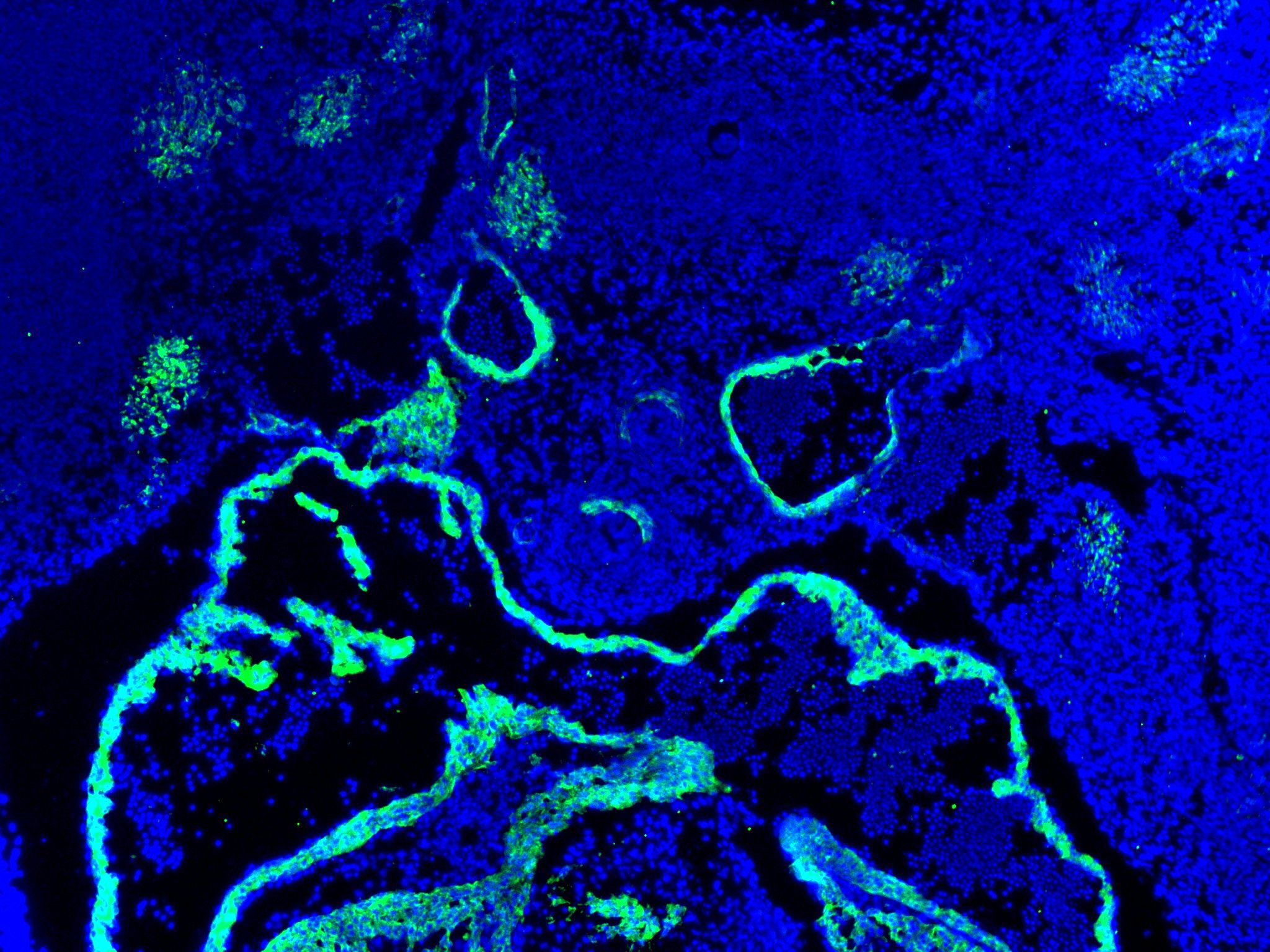alpha-Smooth Muscle Actin Antibody - BSA Free NBP1-30894