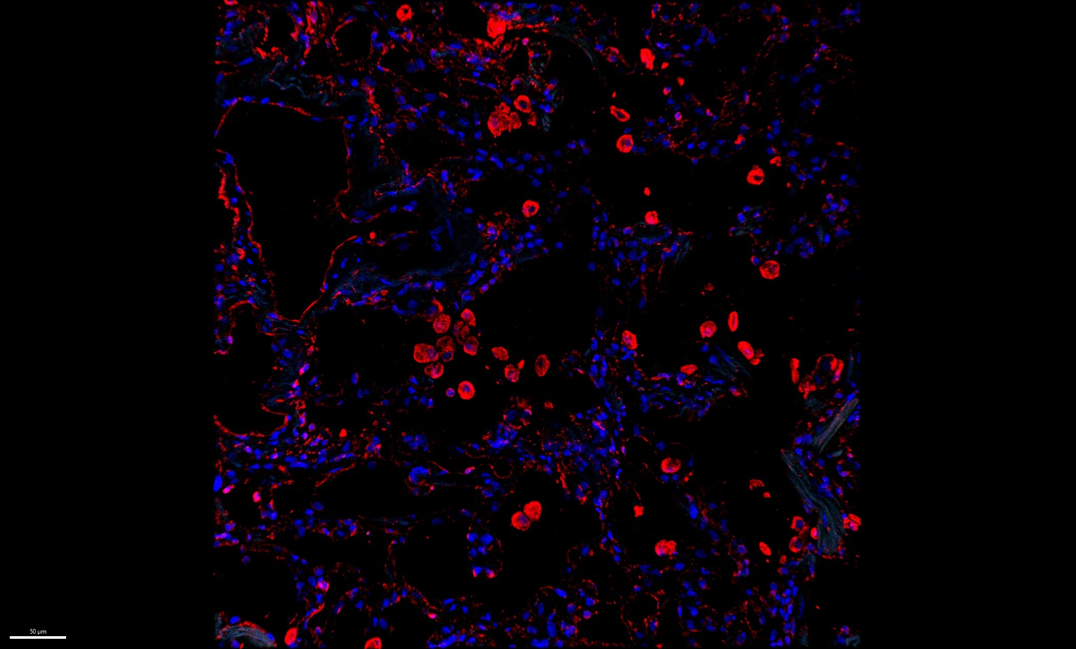 CXCL14/BRAK Antibody - BSA Free NBP1-31398