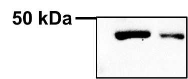 Isocitrate Dehydrogenase 1/IDH1 Antibody - BSA Free NBP1-31599