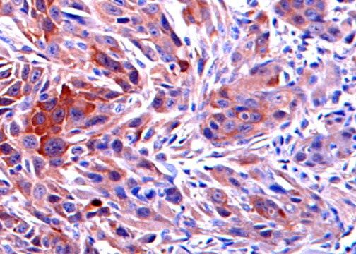 RRM2 Antibody - Azide Free NBP1-31661