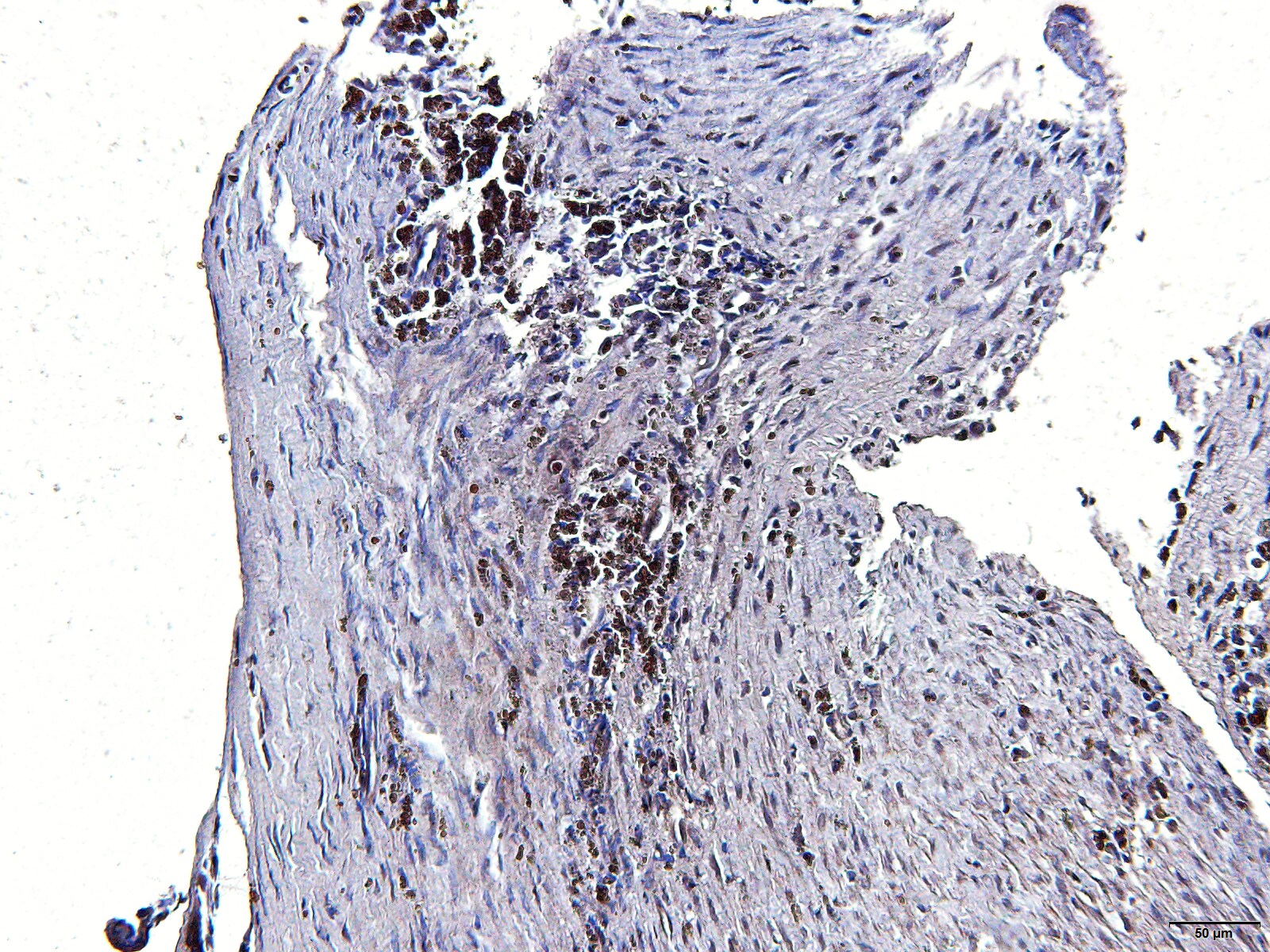BMPR-II Antibody NBP1-32218