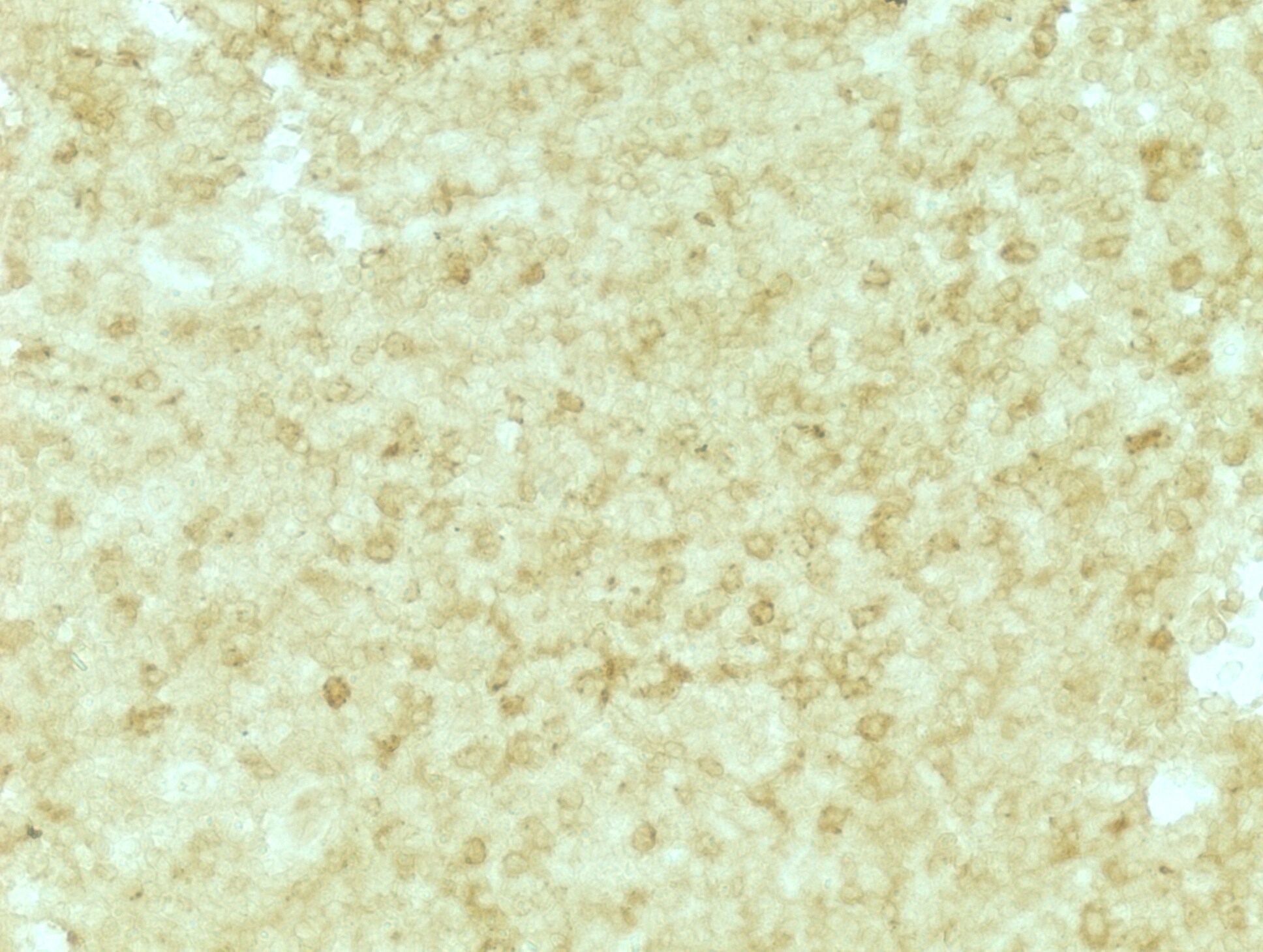 MxA/Mx1 Antibody - BSA Free NBP1-32905