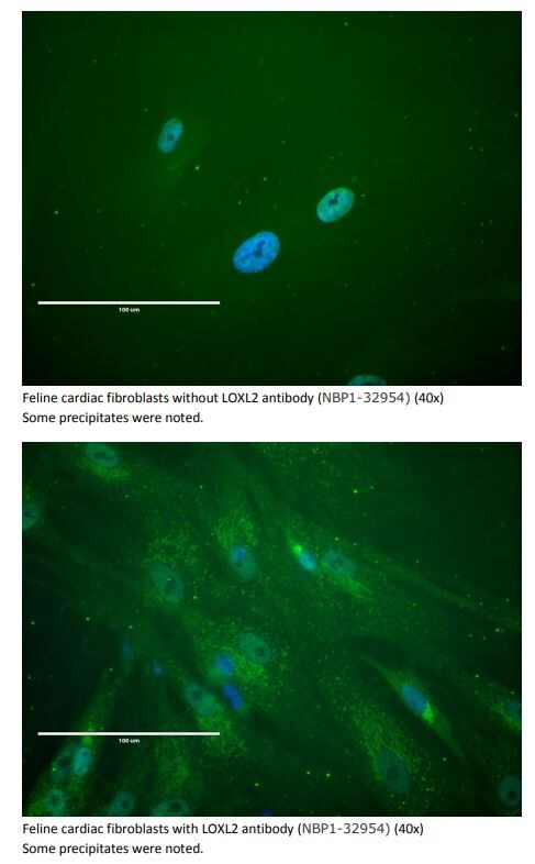 Lysyl Oxidase Homolog 2/LOXL2 Antibody - BSA Free NBP1-32954