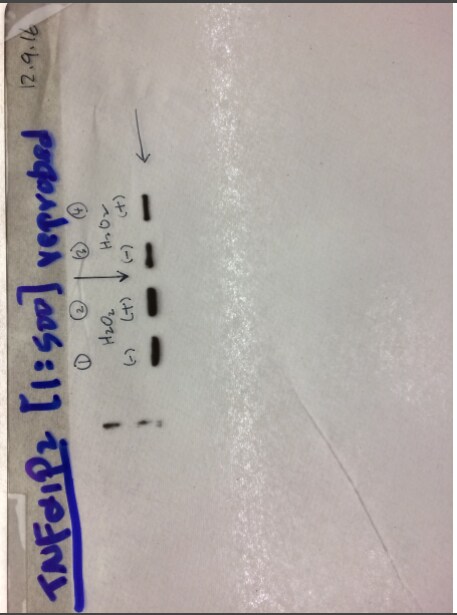 TNFAIP2 Antibody NBP1-33480