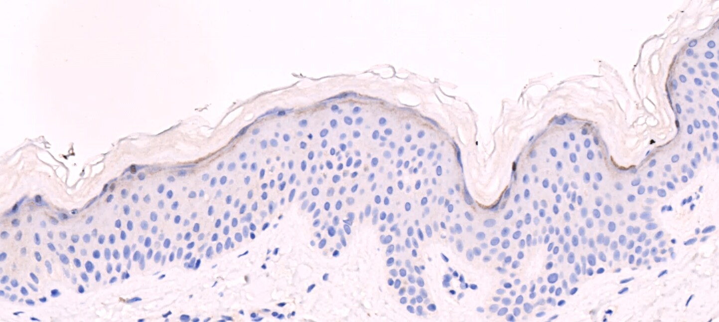 Loricrin Antibody NBP1-33610