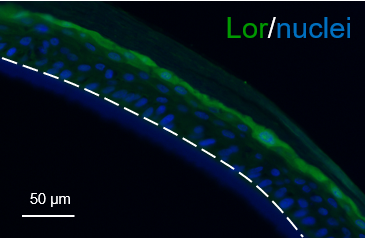 Loricrin Antibody NBP1-33610