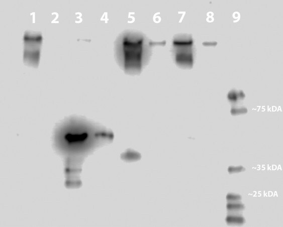 CYBB/NOX2 Antibody (NL7) - BSA Free NBP1-41012