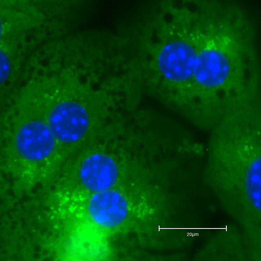 p62/SQSTM1 Antibody - BSA Free NBP1-42821